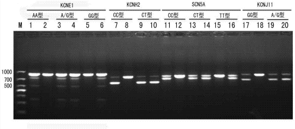 Rapid gene detection kit and rapid gene detection method for sudden cardiac death