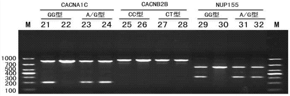 Rapid gene detection kit and rapid gene detection method for sudden cardiac death