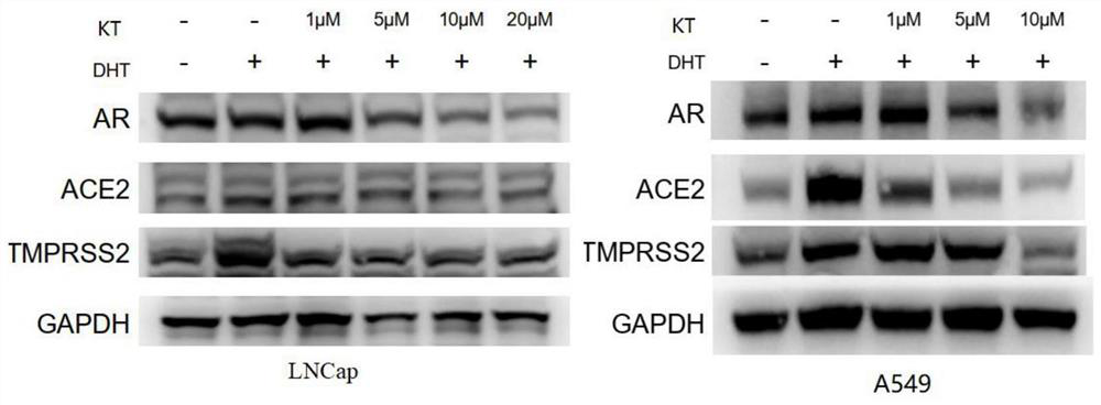 Application of thioimidazolidinone medicine for treating COVID-19 diseases