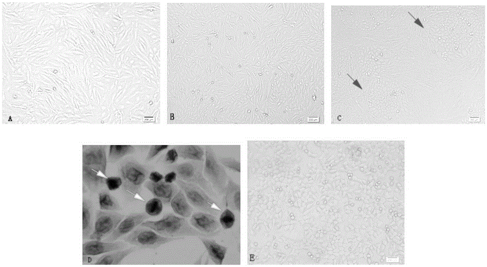 Application of Astragalus polysaccharide in bone marrow mesenchymal stem cells