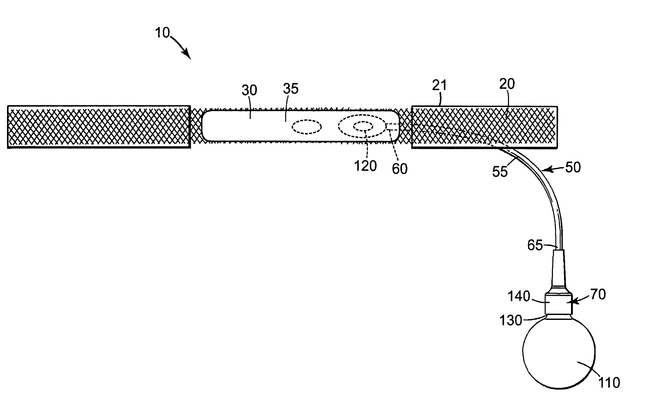 Male urethral prosthesis