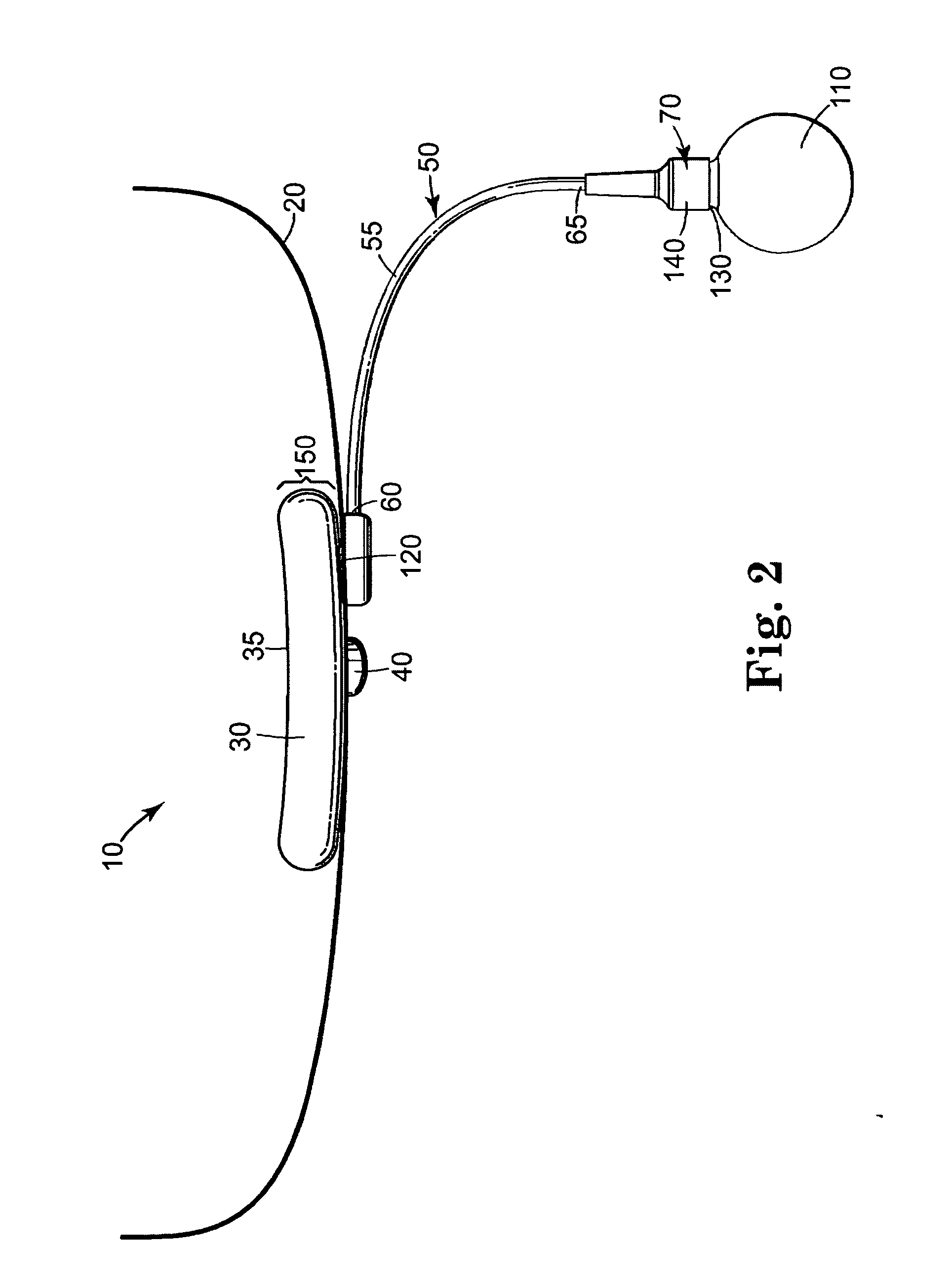 Male urethral prosthesis