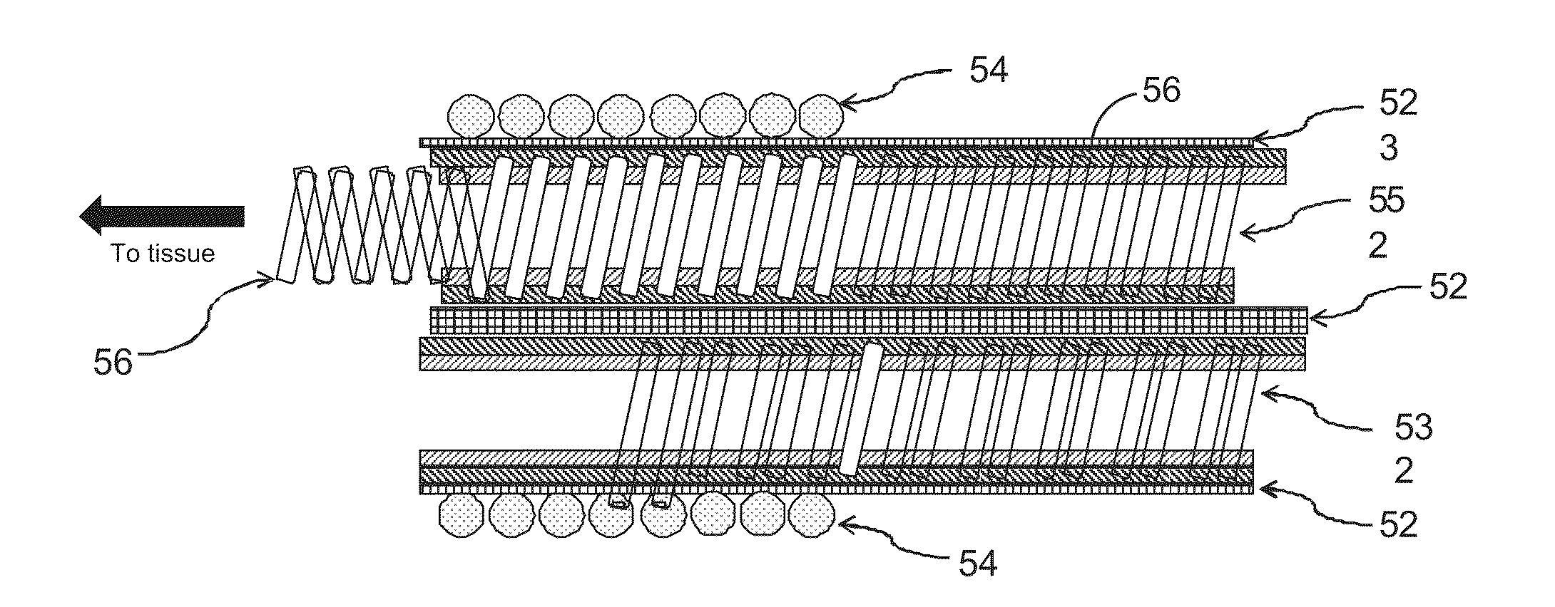 MRI compatible implantable electronic medical lead