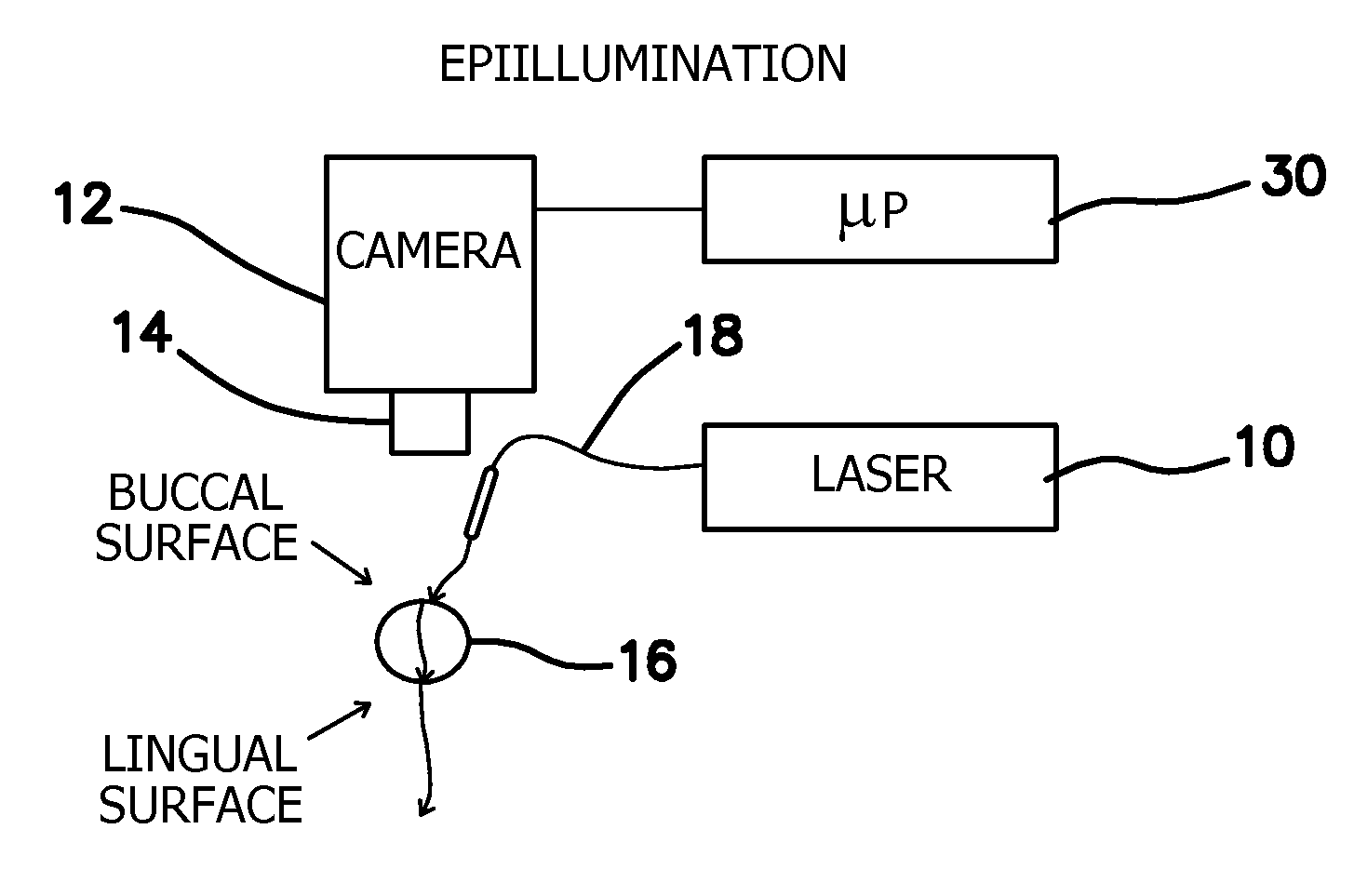 Method and apparatus for the assessment of pulpal vitality using laser speckle imaging