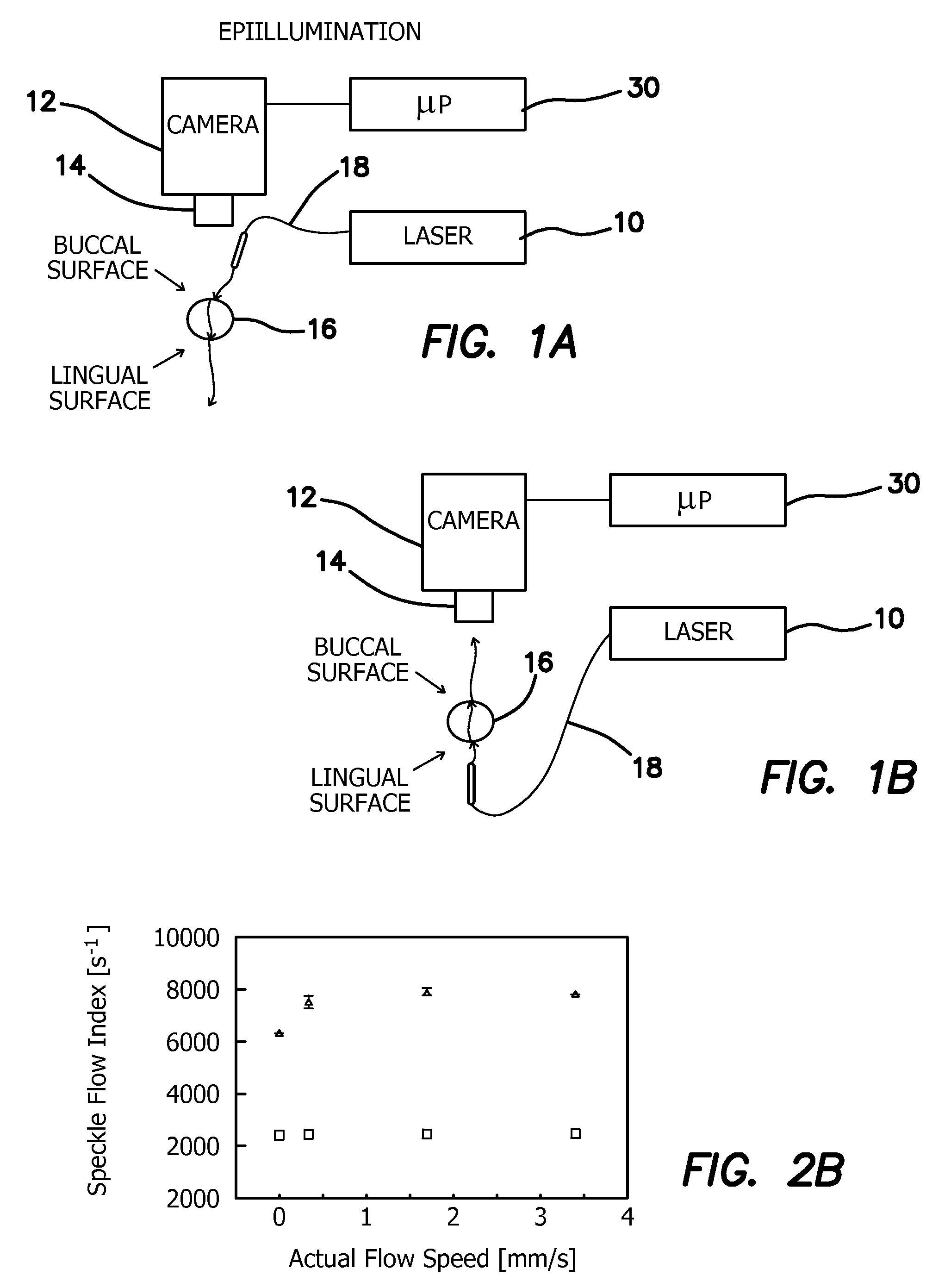 Method and apparatus for the assessment of pulpal vitality using laser speckle imaging