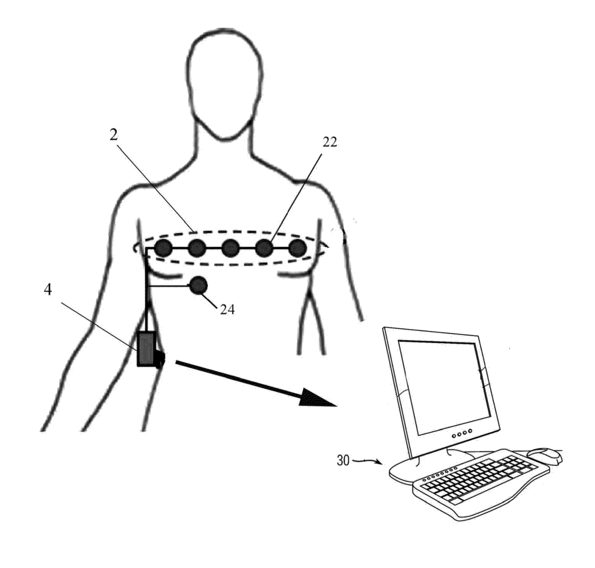 Method and apparatus to monitor physiologic and biometric parameters using a non-invasive set of transducers