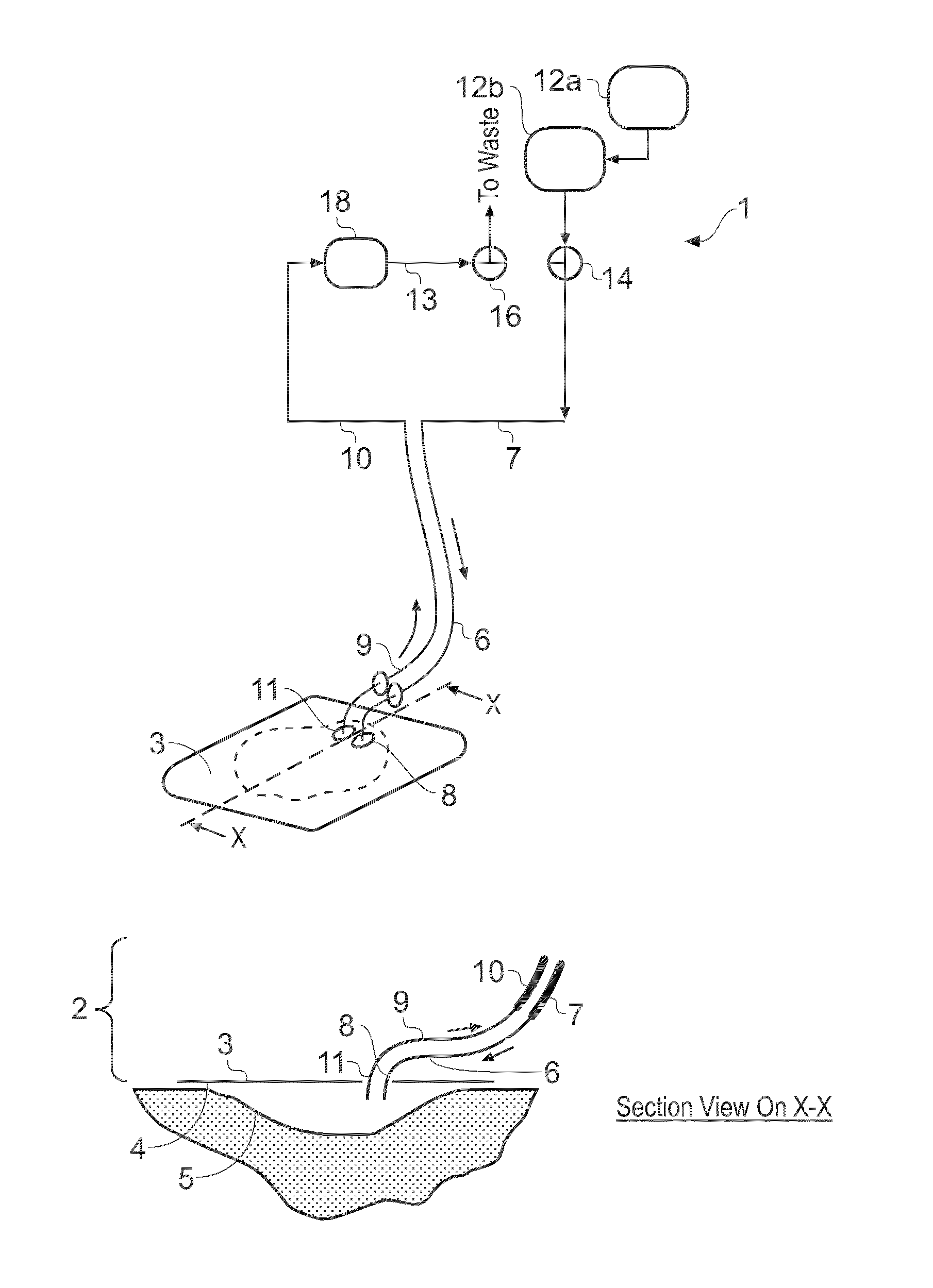 Wound treatment apparatus and method