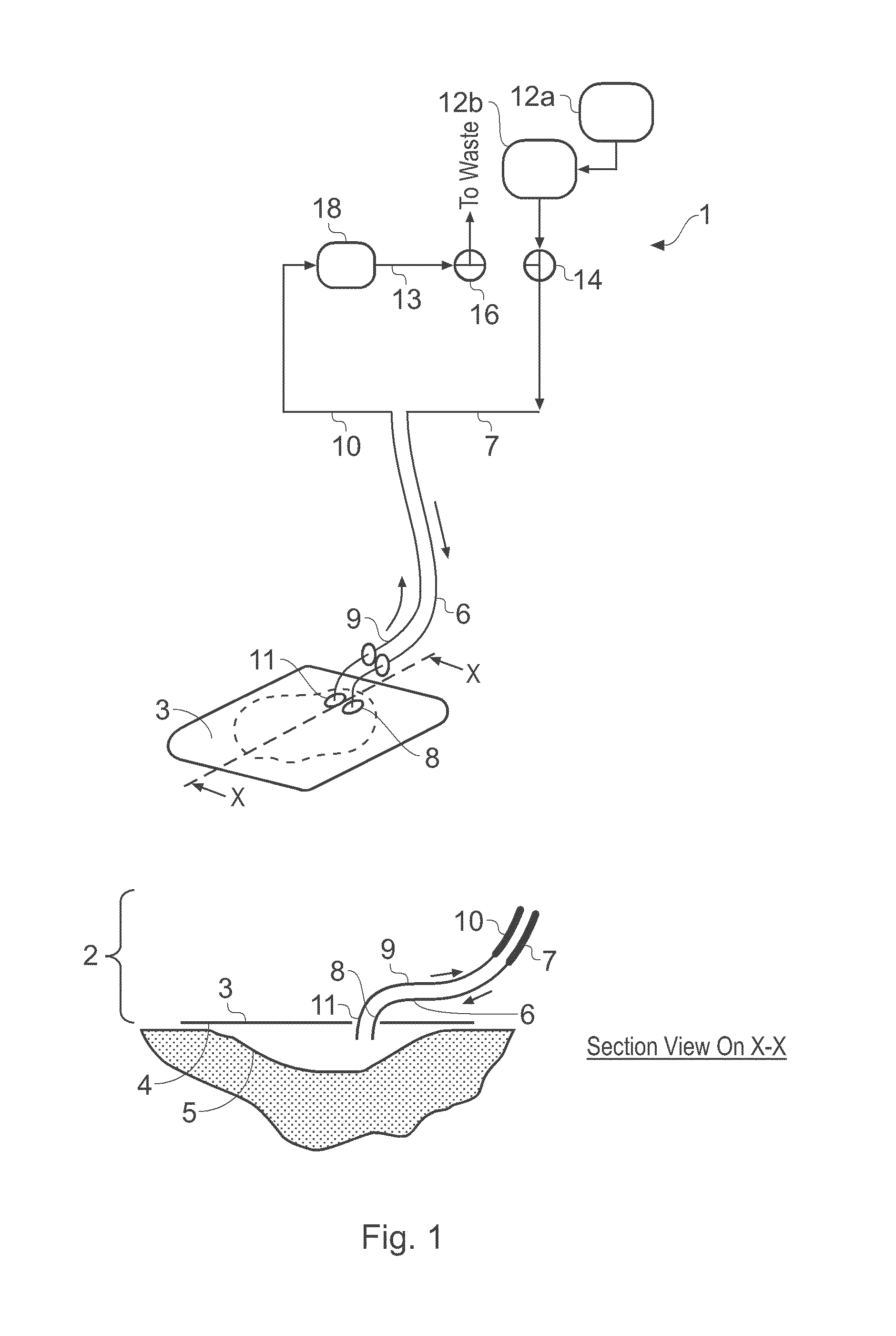 Wound treatment apparatus and method