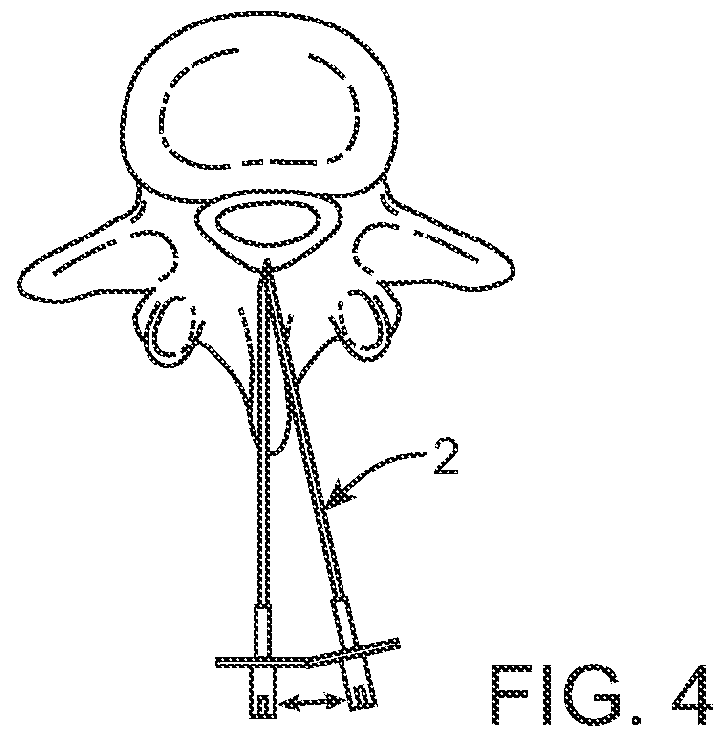 Devices and methods for tissue access