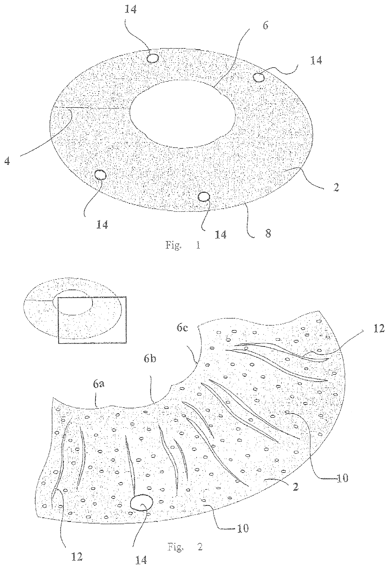 Cosmetic corneal inlay and implantation method thereof