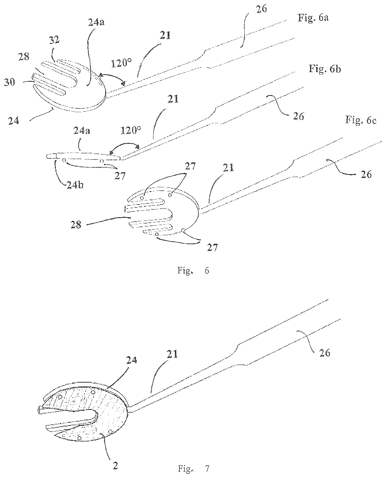 Cosmetic corneal inlay and implantation method thereof