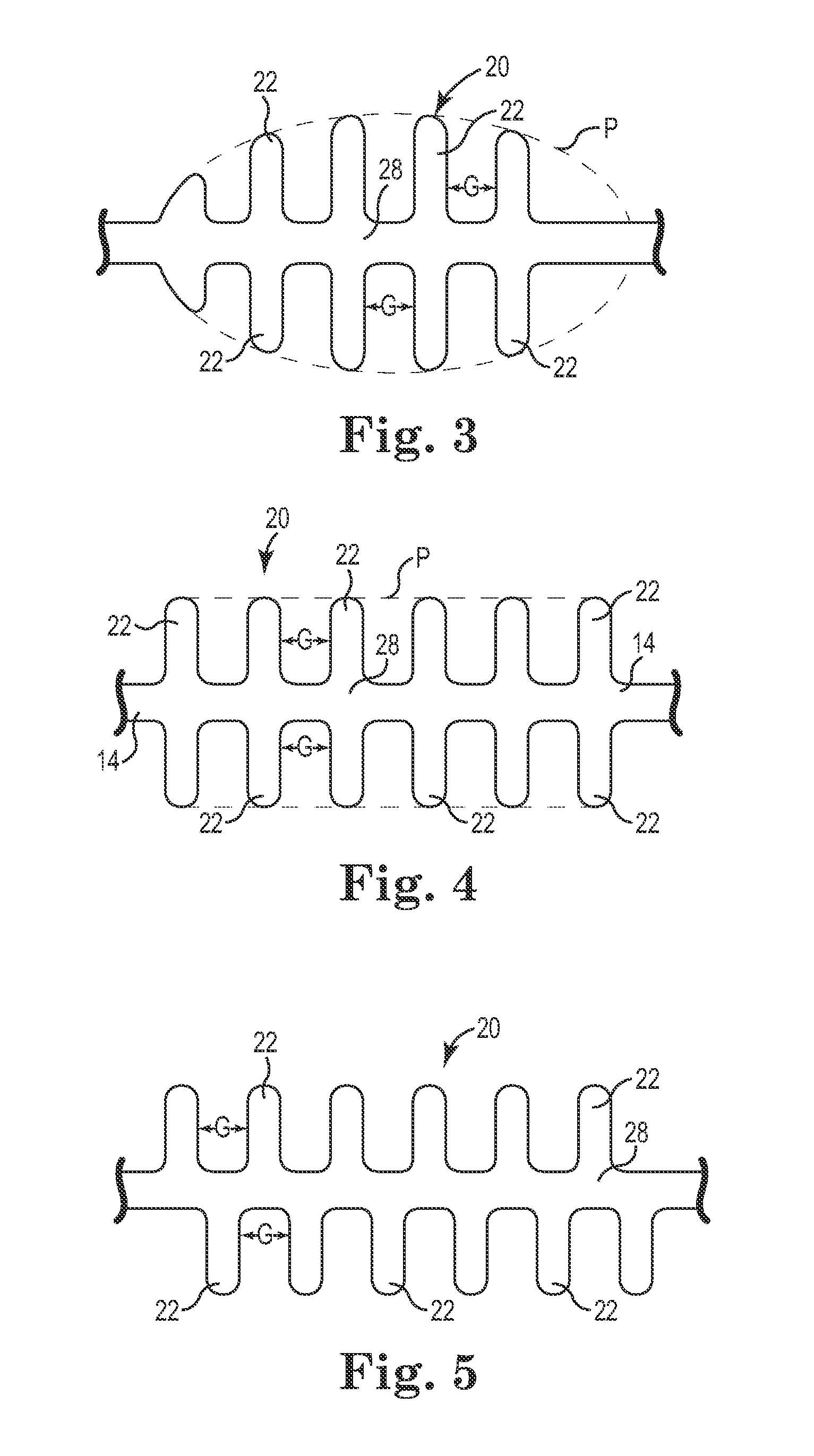 Fold-Resistant Pelvic Implant System and Method