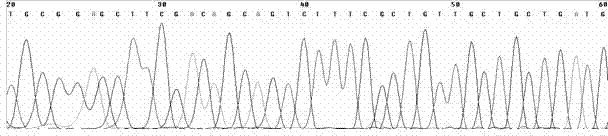 Multiple rapid detection method for three food borne pathogenic bacteria, and detection primer set and kit thereof