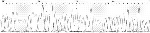 Multiple rapid detection method for three food borne pathogenic bacteria, and detection primer set and kit thereof