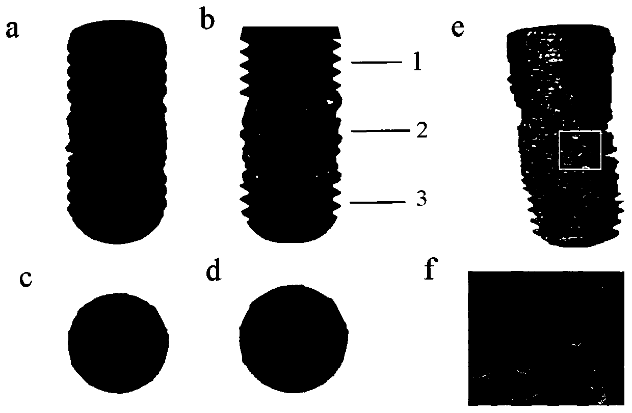 Bone trabecula porous tantalum dental implant and preparation method thereof