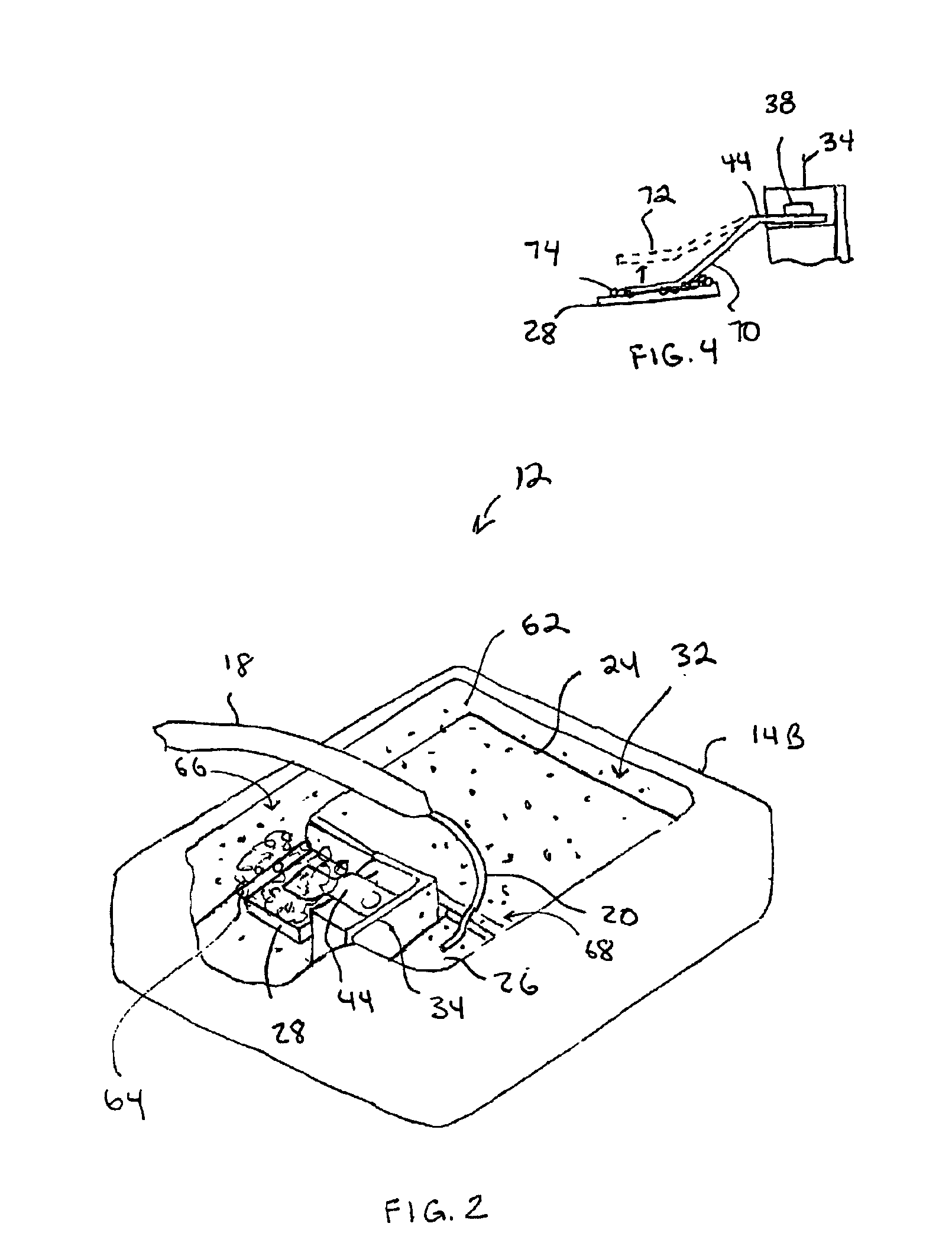 Surge suppressor enclosure and fusing system