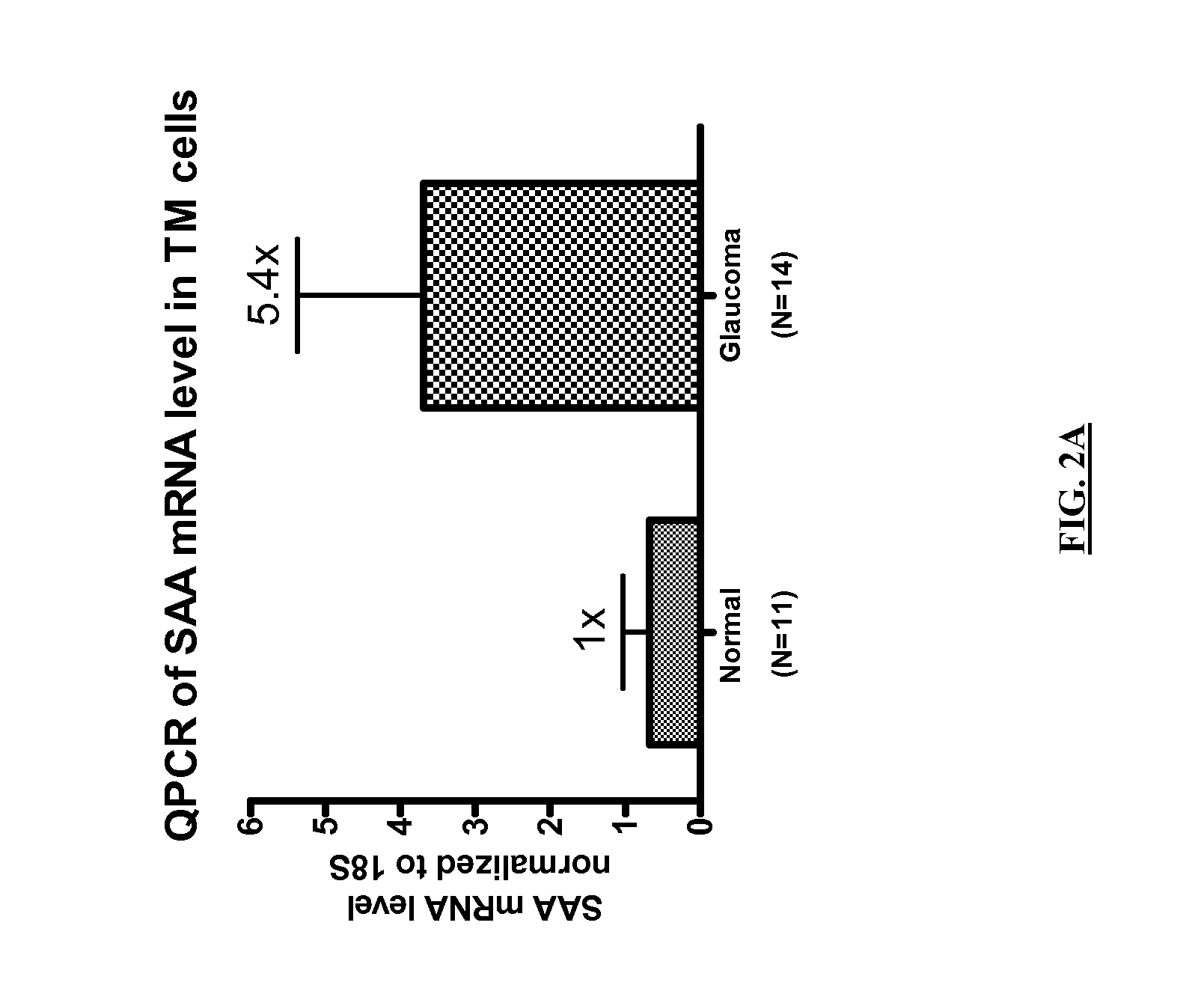 Use of serum amyloid A gene in diagnosis and treatment of glaucoma and identification of anti-glaucoma agents