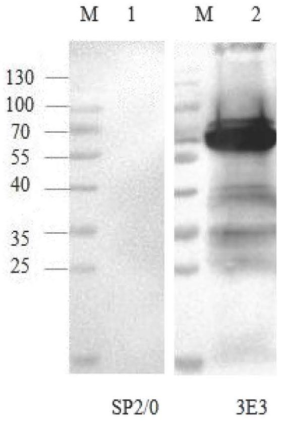 Pasteurella multocida toxin monoclonal antibody and blocking ELISA kit thereof