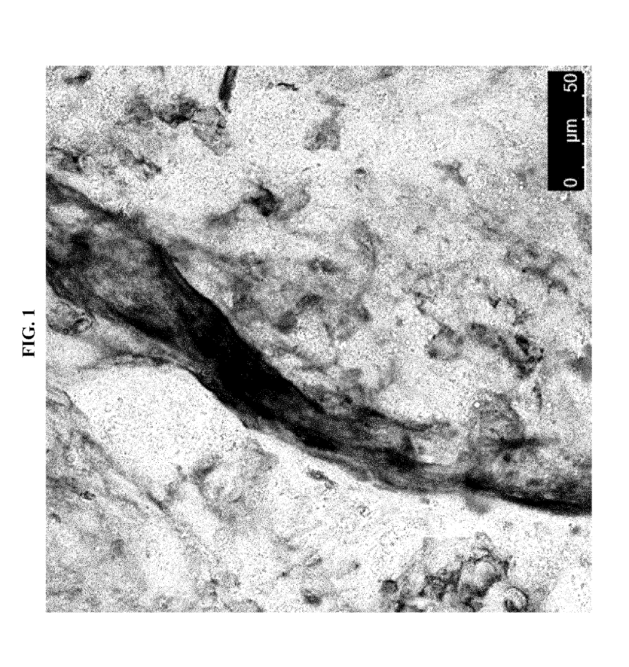 Cardiac fibroblast-derived extracellular matrix and injectable formulations thereof for treatment of ischemic disease or injury