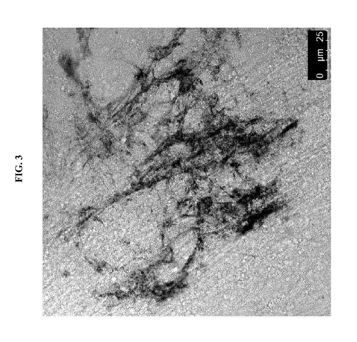 Cardiac fibroblast-derived extracellular matrix and injectable formulations thereof for treatment of ischemic disease or injury