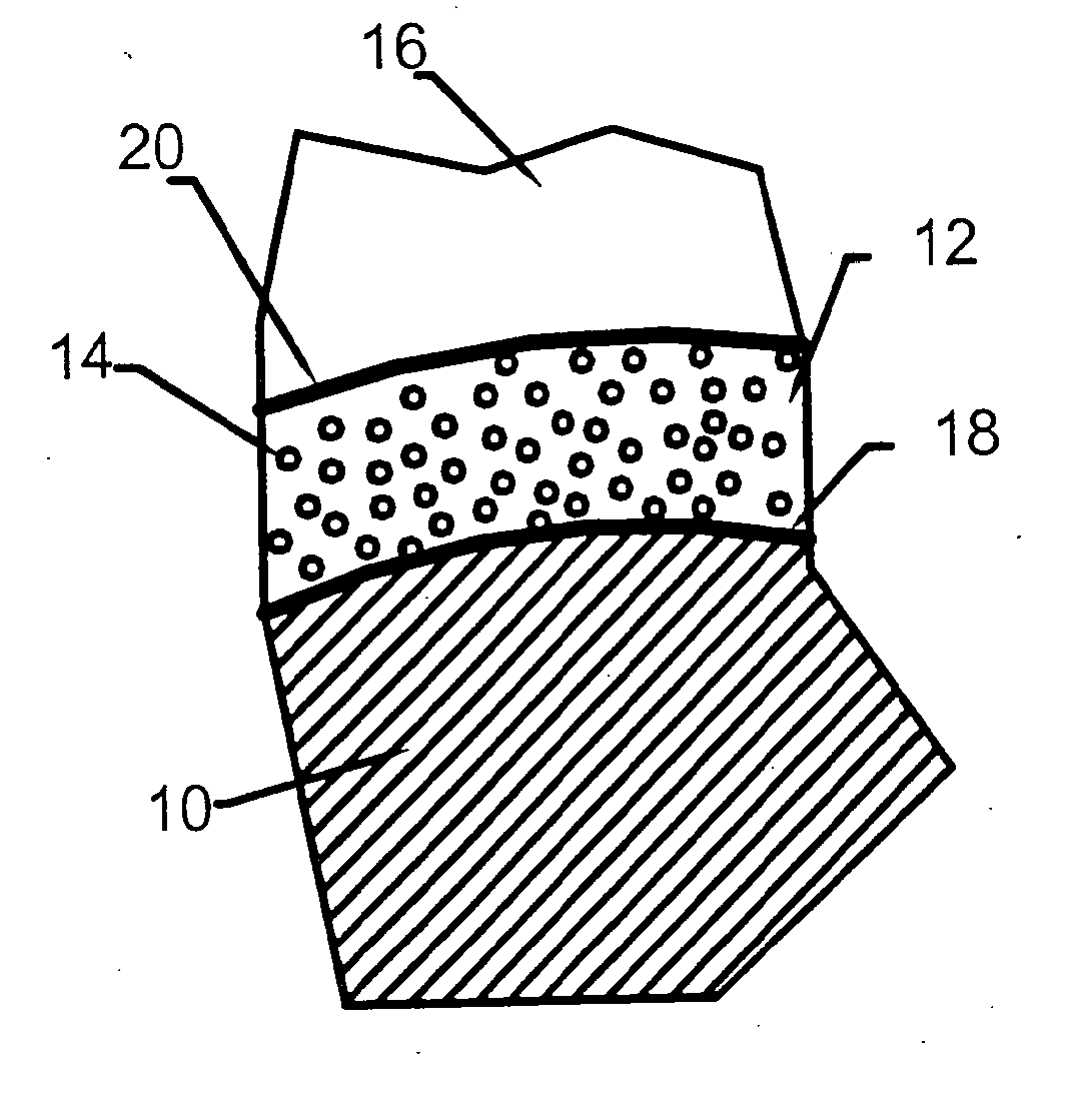 Ceramic-forming polymer material