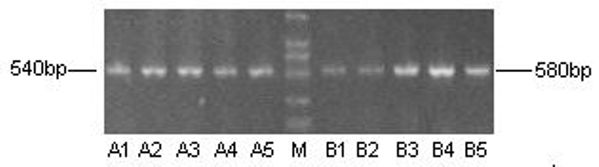 Marker HCCR-1 protein highly expressed in colon cancer tissue and prognostic marker for colon cancer