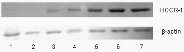 Marker HCCR-1 protein highly expressed in colon cancer tissue and prognostic marker for colon cancer