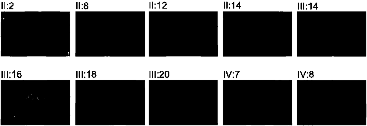 Distal arthrogryposis disease pathogenic gene and use thereof