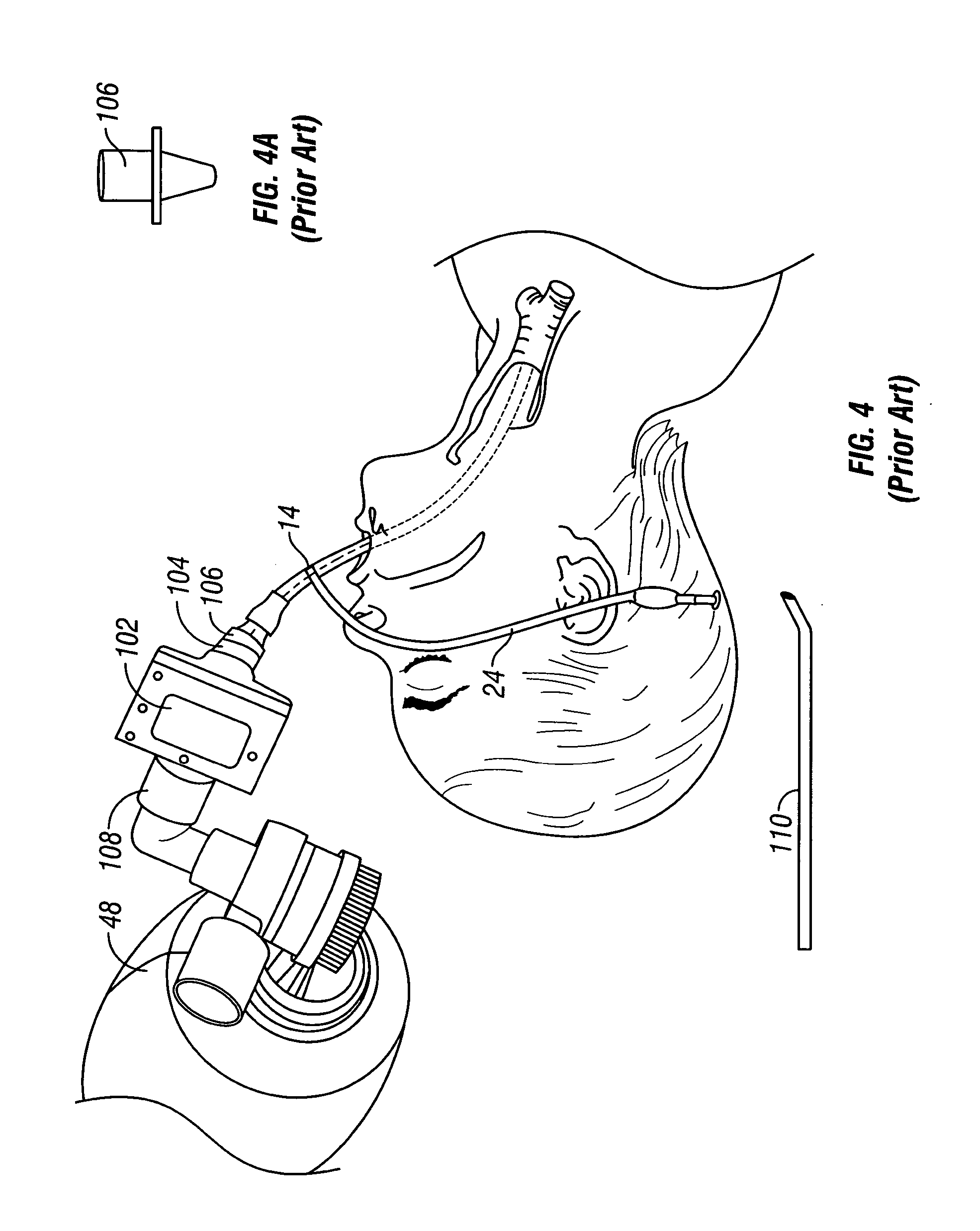 Endotracheal tube system and method of use