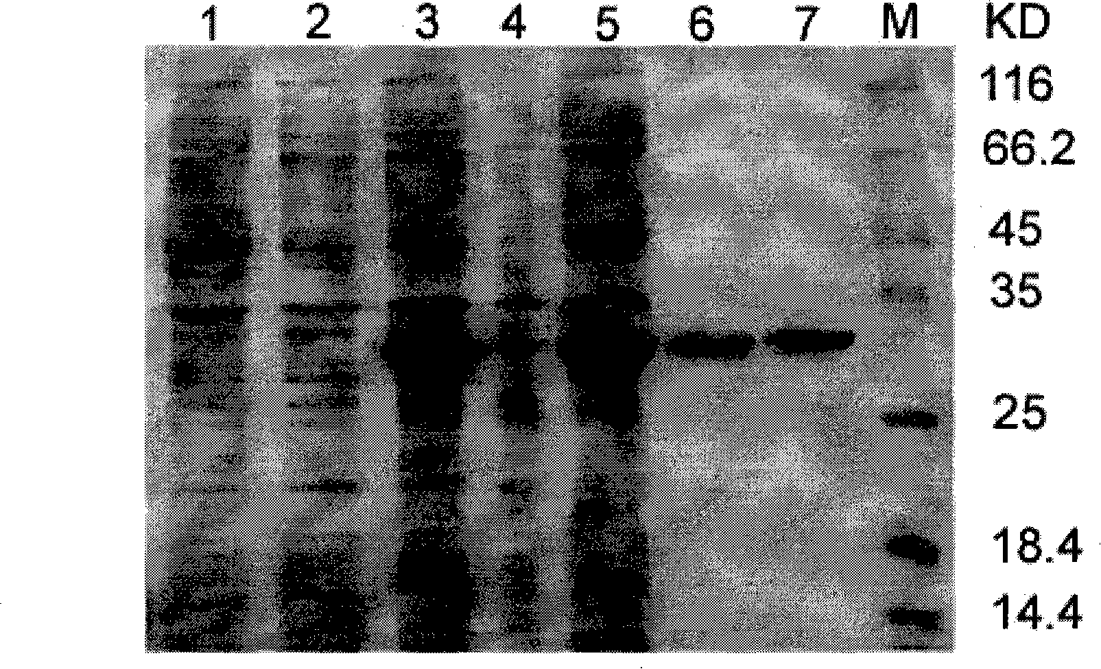 SEC2 mutant gene with increased activity of super-antigen and preparation method thereof