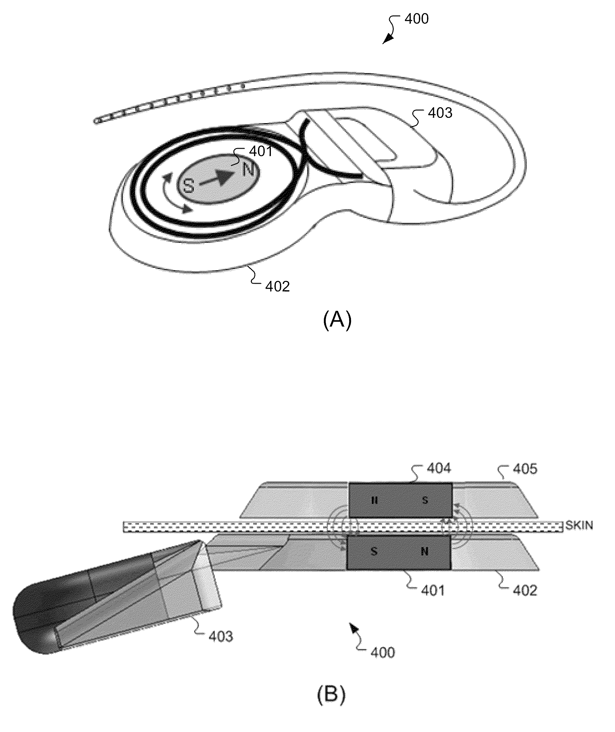 MRI-safe disc magnet for implants