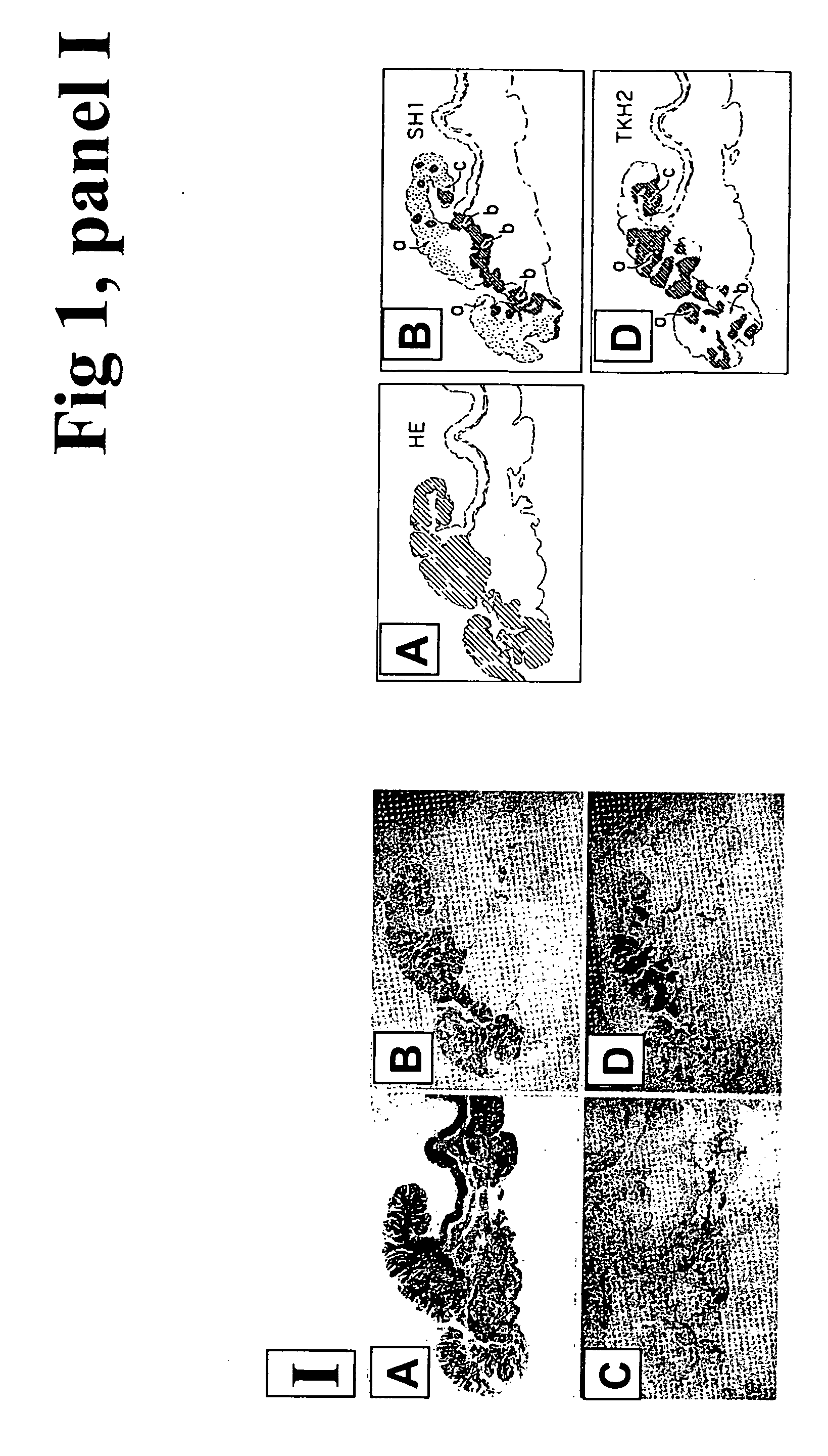 Surface plasmon resonance biosensor system for detection of antigens and method for determining the presence of antigens