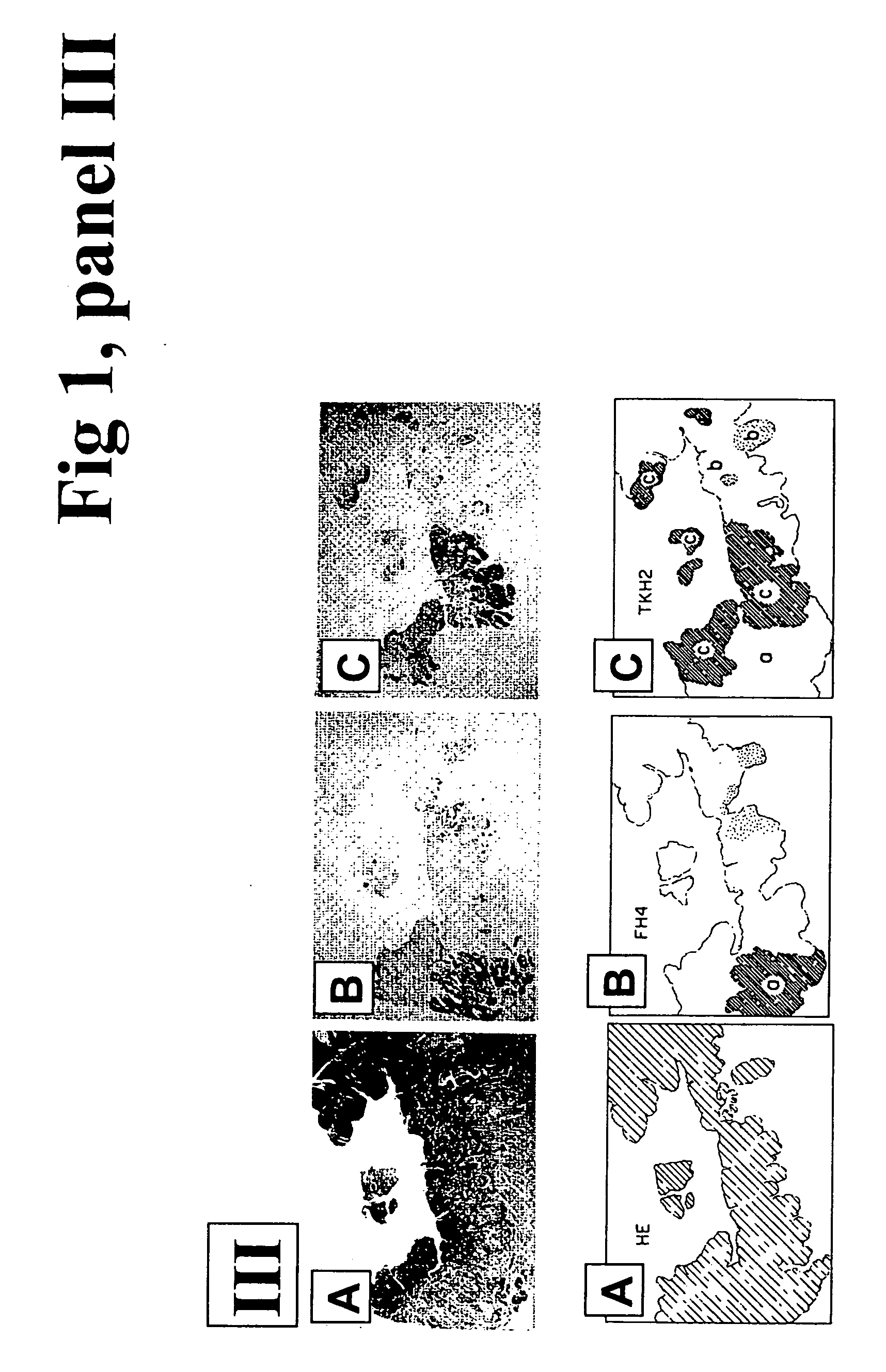 Surface plasmon resonance biosensor system for detection of antigens and method for determining the presence of antigens