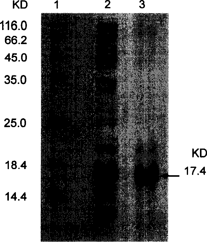 Nerve growth factor combined with collagen specificity and its coading gene and application