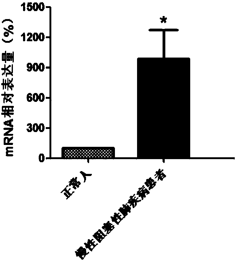 Application of TMTC1 gene as novel molecular marker