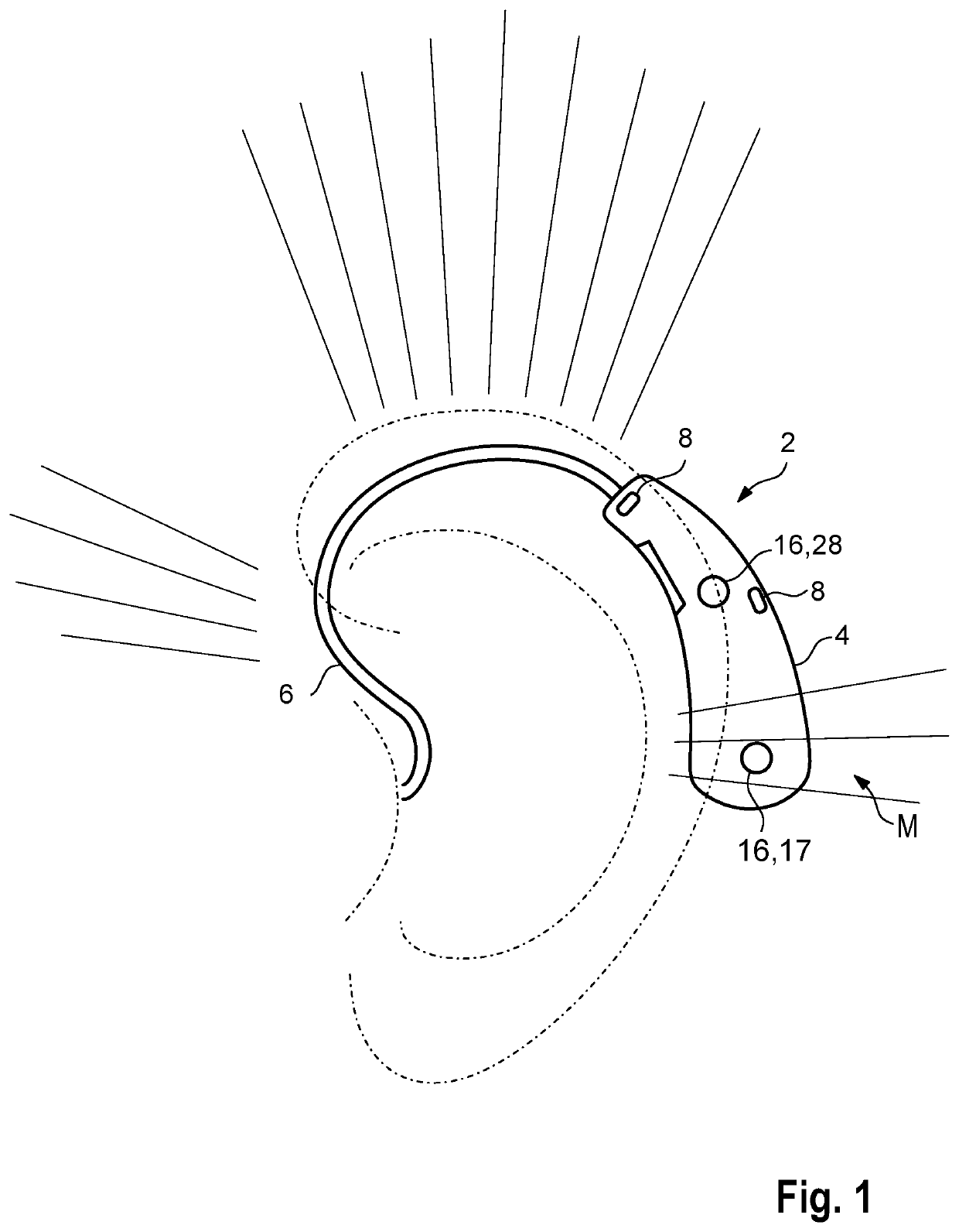 Method for operating a hearing device and hearing device