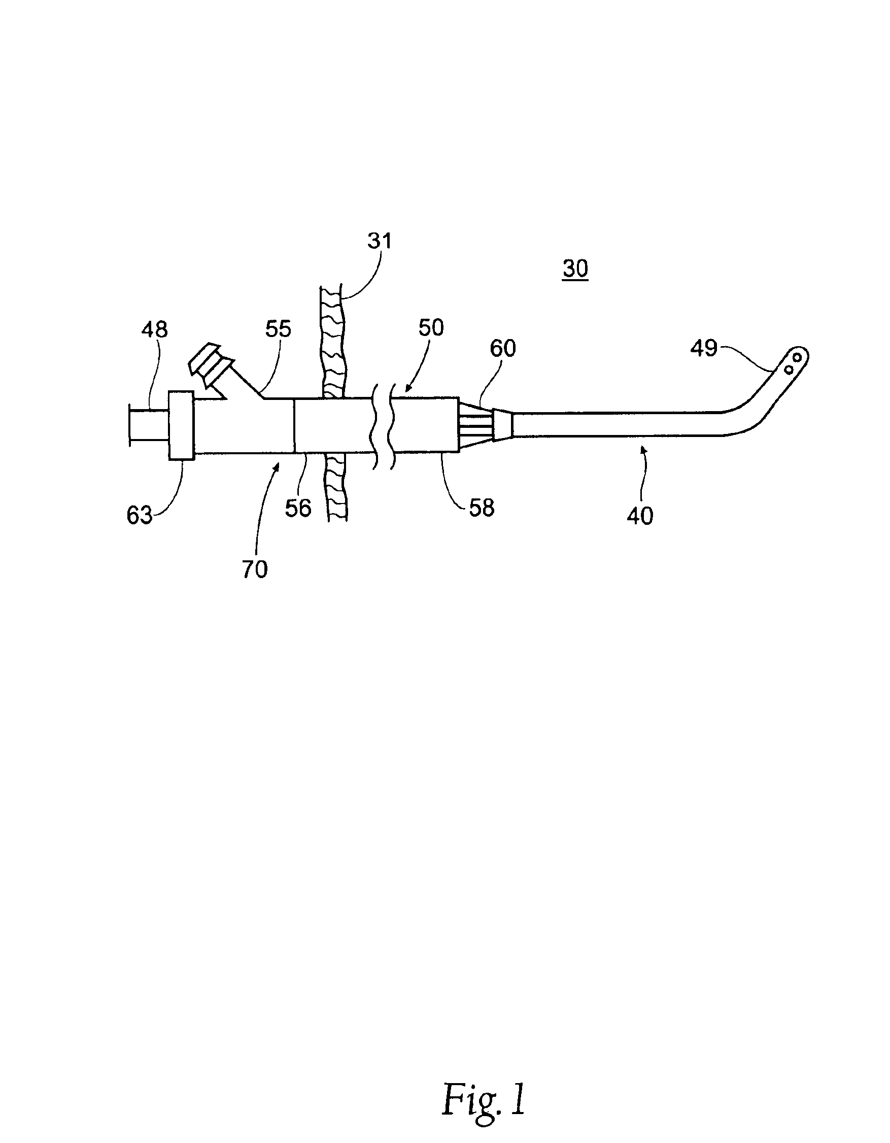 Intravascular cannulation apparatus and methods of use