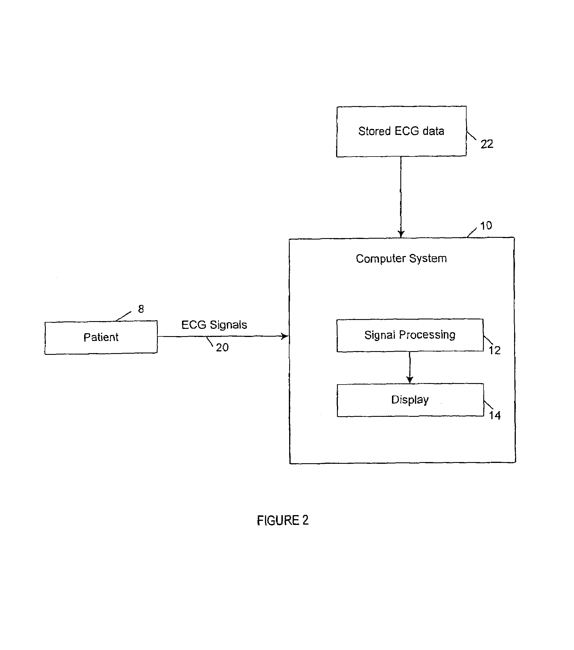 Method and system for processing electrocardial signals