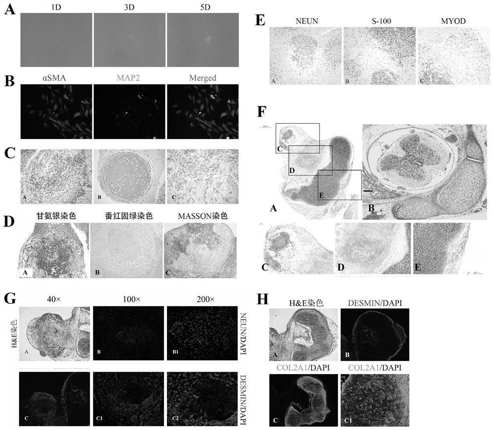 Culture system and method for inducing human pluripotent stem cells into neural mesoderm progenitor cells in vitro and maintaining self-renewal and application