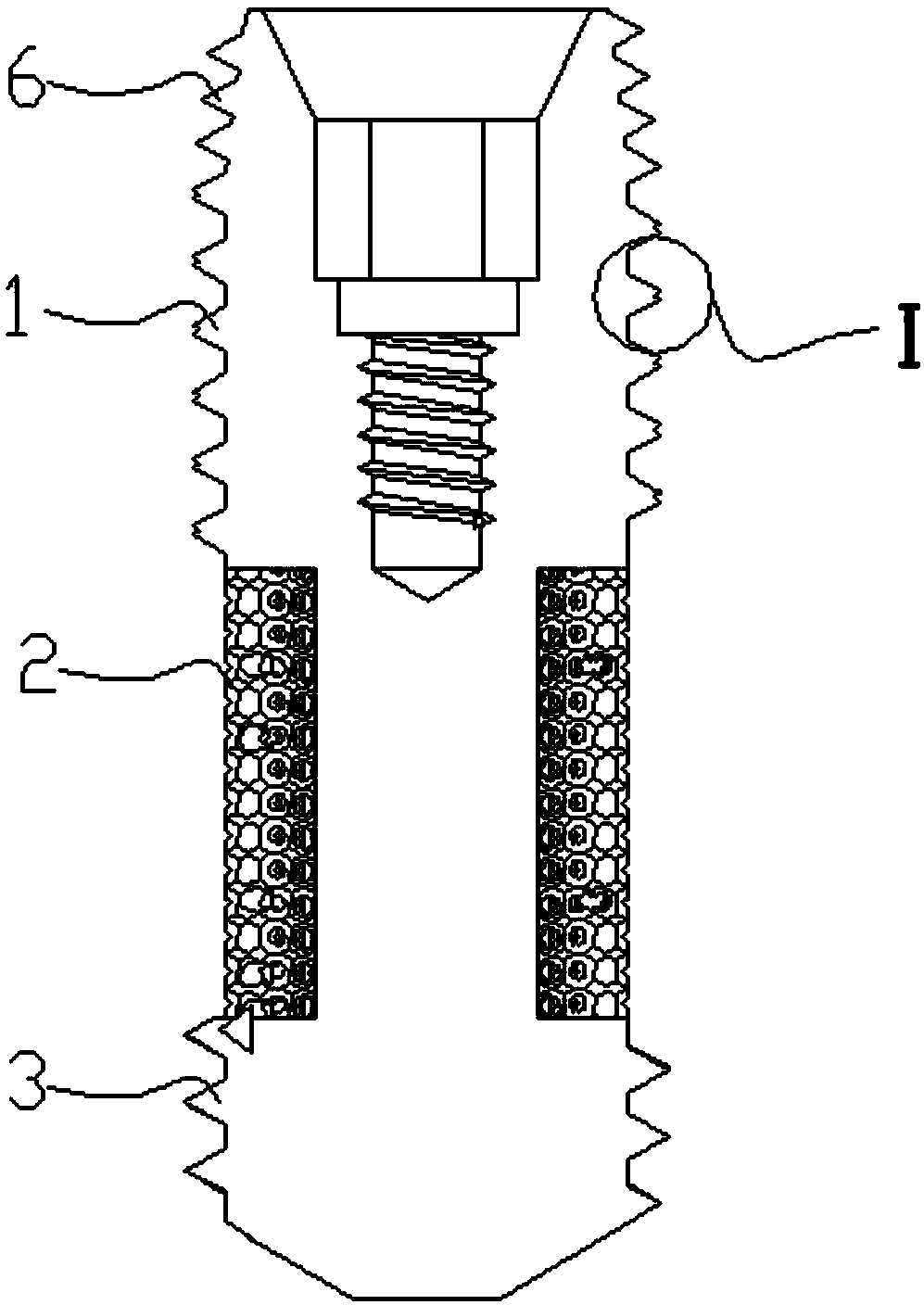 Porous structure titanium implant for dental implant