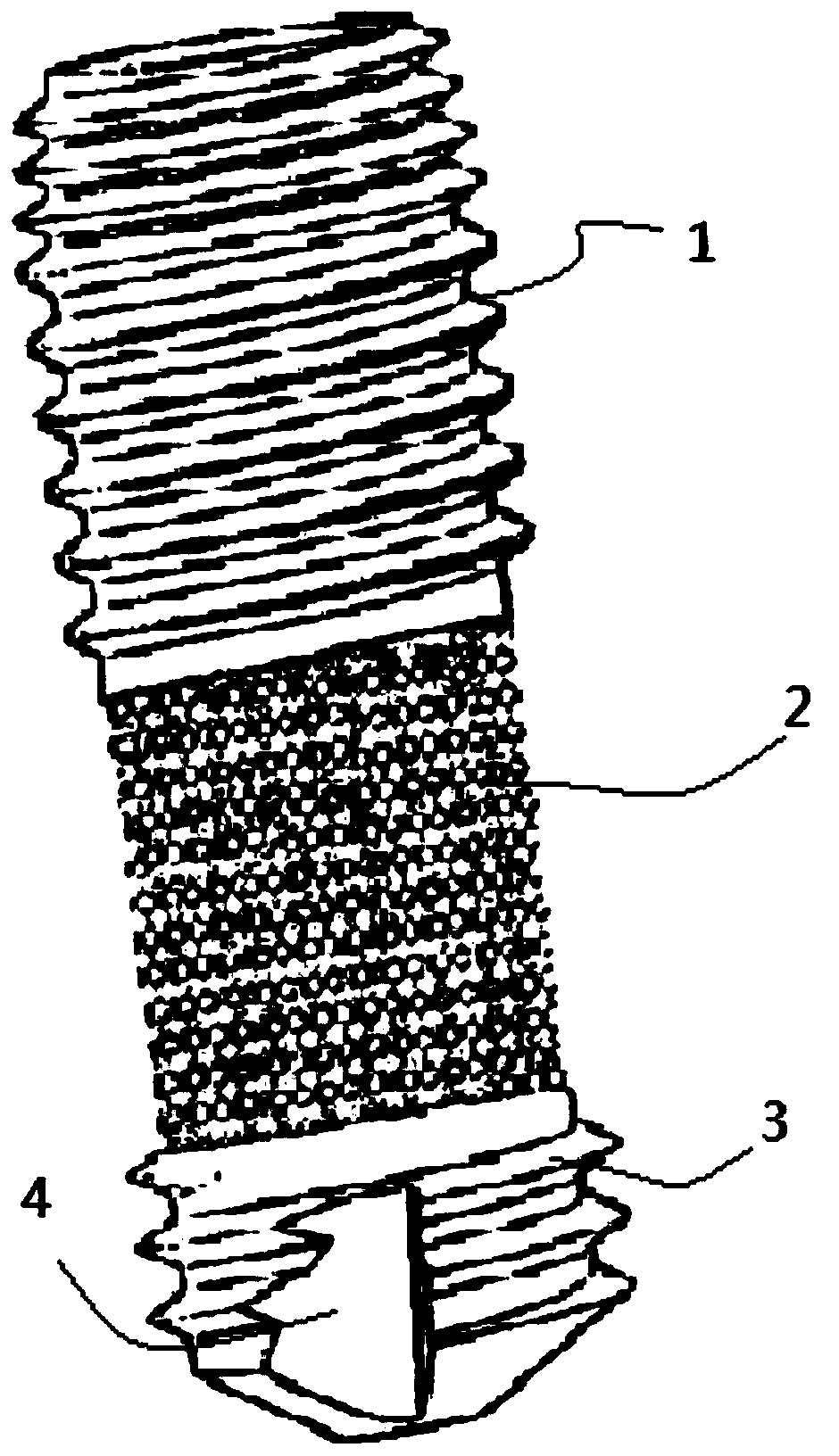 Porous structure titanium implant for dental implant