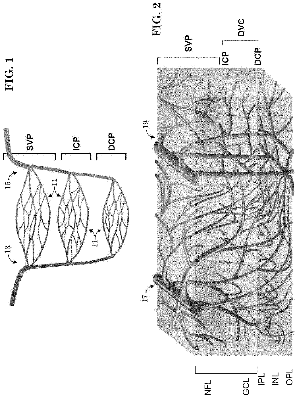 Oct-based retinal artery/vein classification