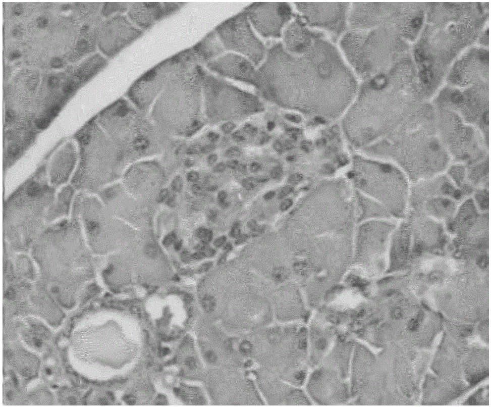 Needle mushroom extract and preparation method and application thereof