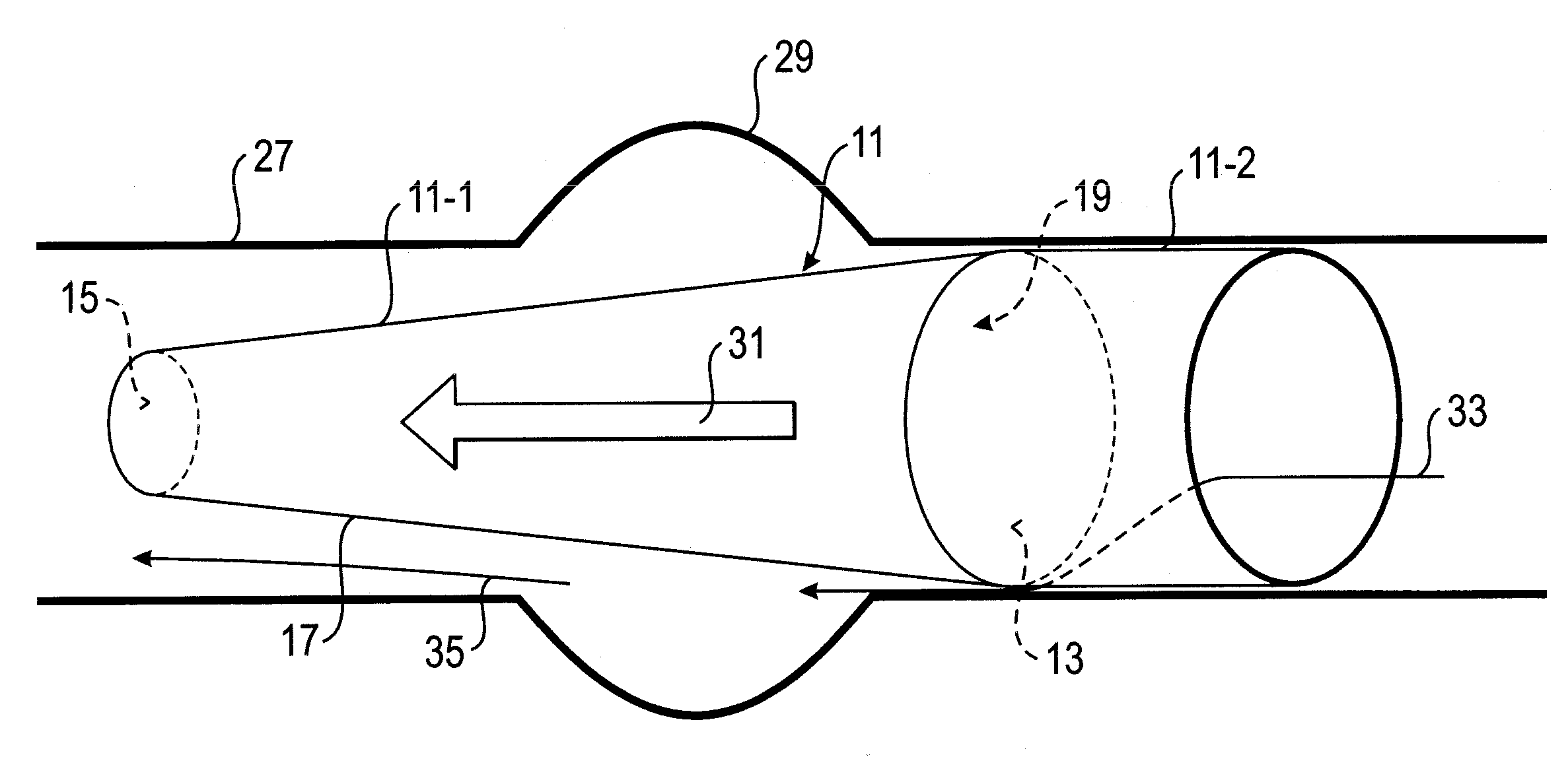 Vessel implant for the treatment of an aneurysm