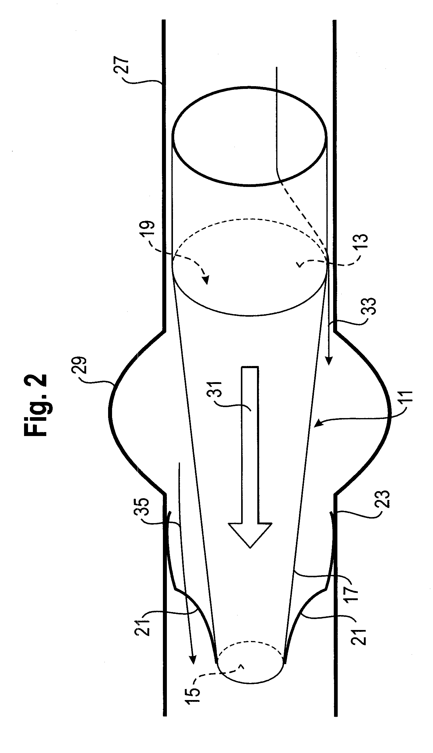 Vessel implant for the treatment of an aneurysm