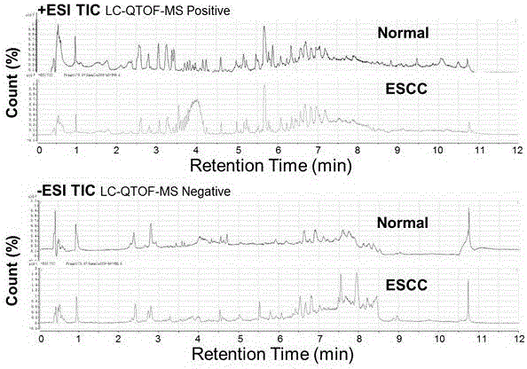 Building method of esophageal squamous cell cancer diagnosis model, obtained diagnosis model and use method of model