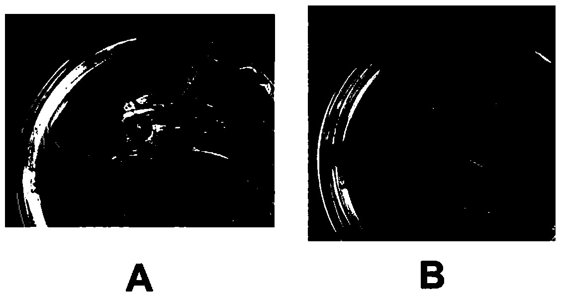 A genetically engineered Staphylococcus aureus phage lyase and its preparation method and application