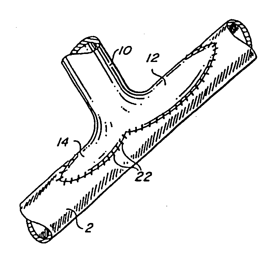 Flanged graft for end-to-side anastomosis