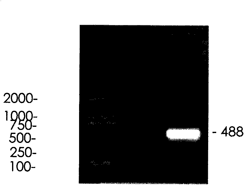 Duck virus hepatitis inactivated vaccine and preparation method thereof