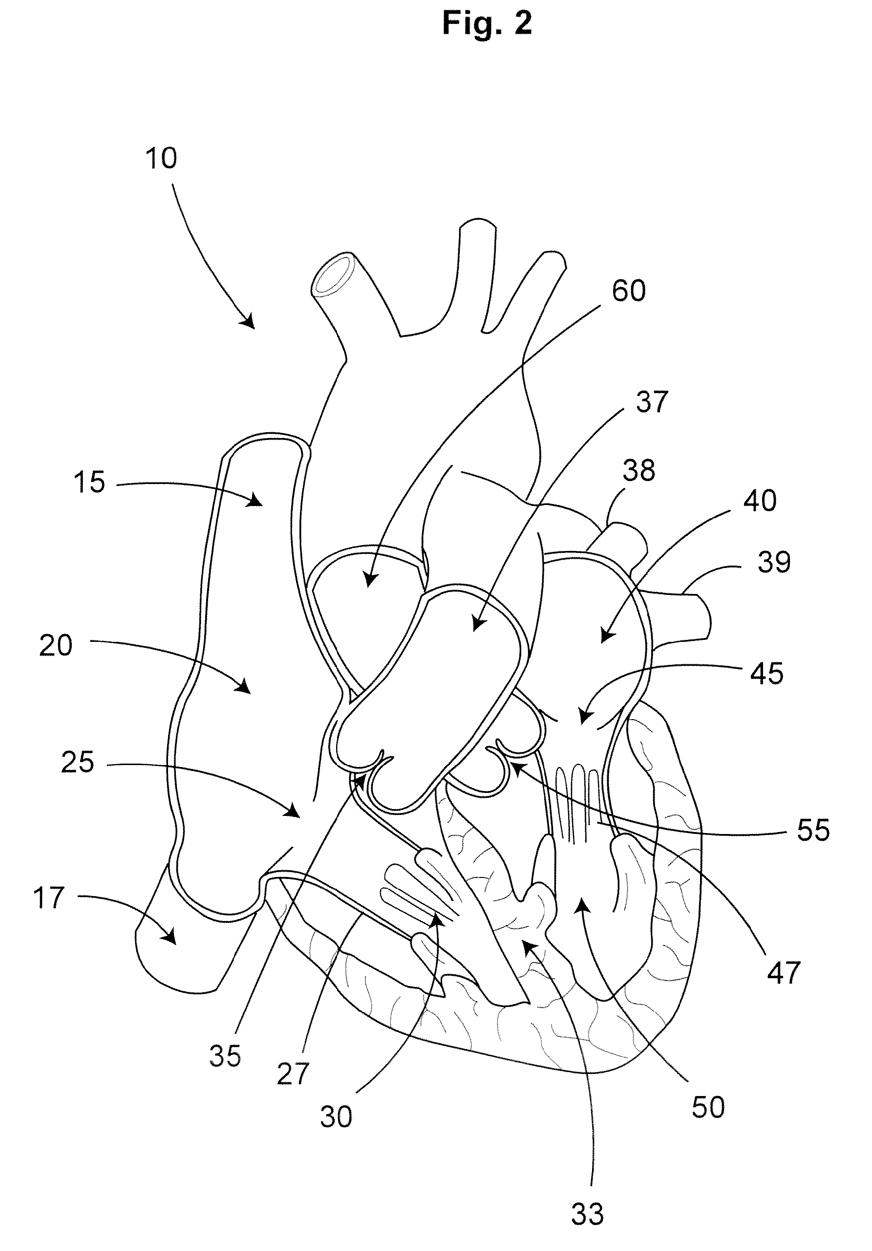 Monitoring physiological condition and detecting abnormalities